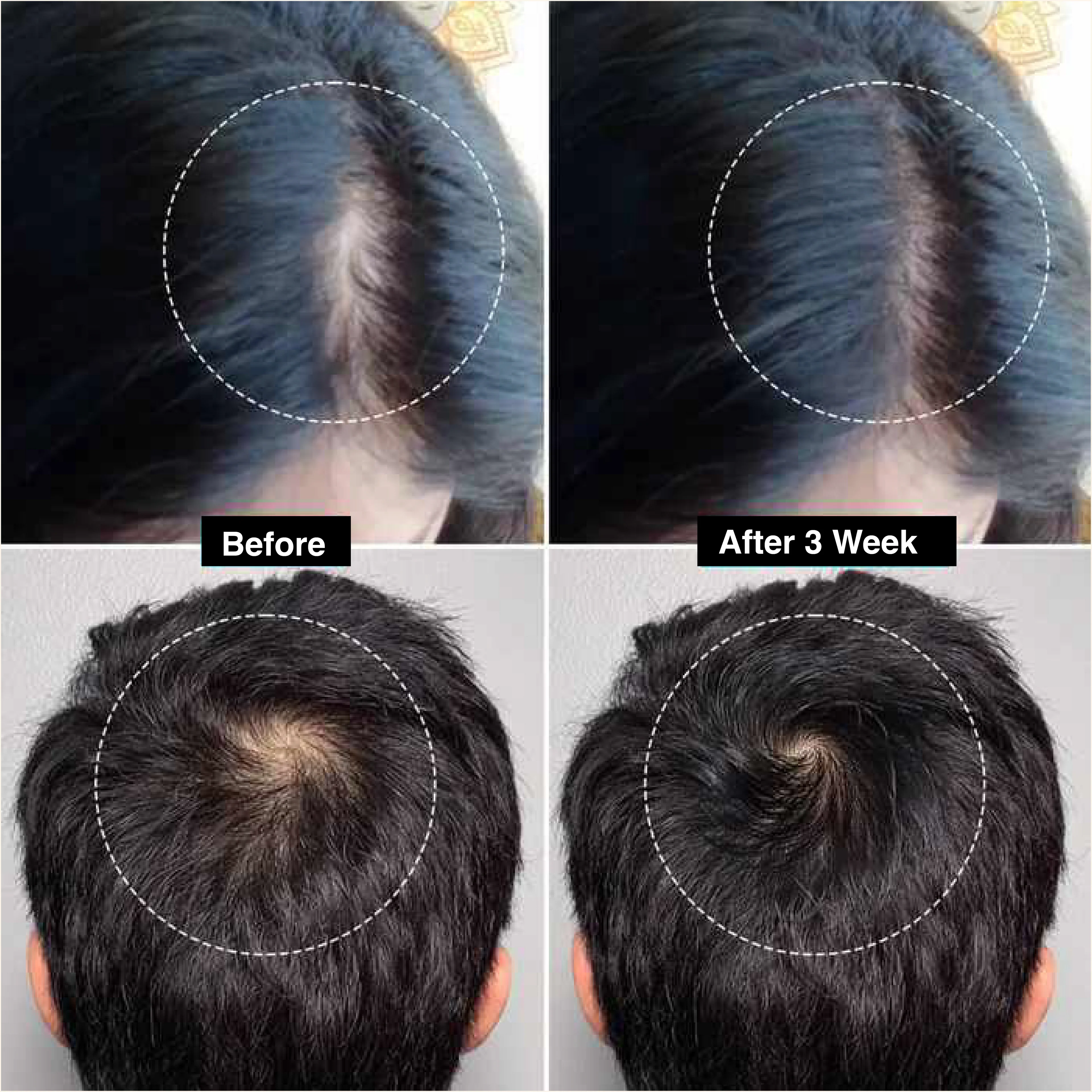Neuron Hair Repair & Growth Serum 50ml | Keratin & Argan Oil | - Image 3