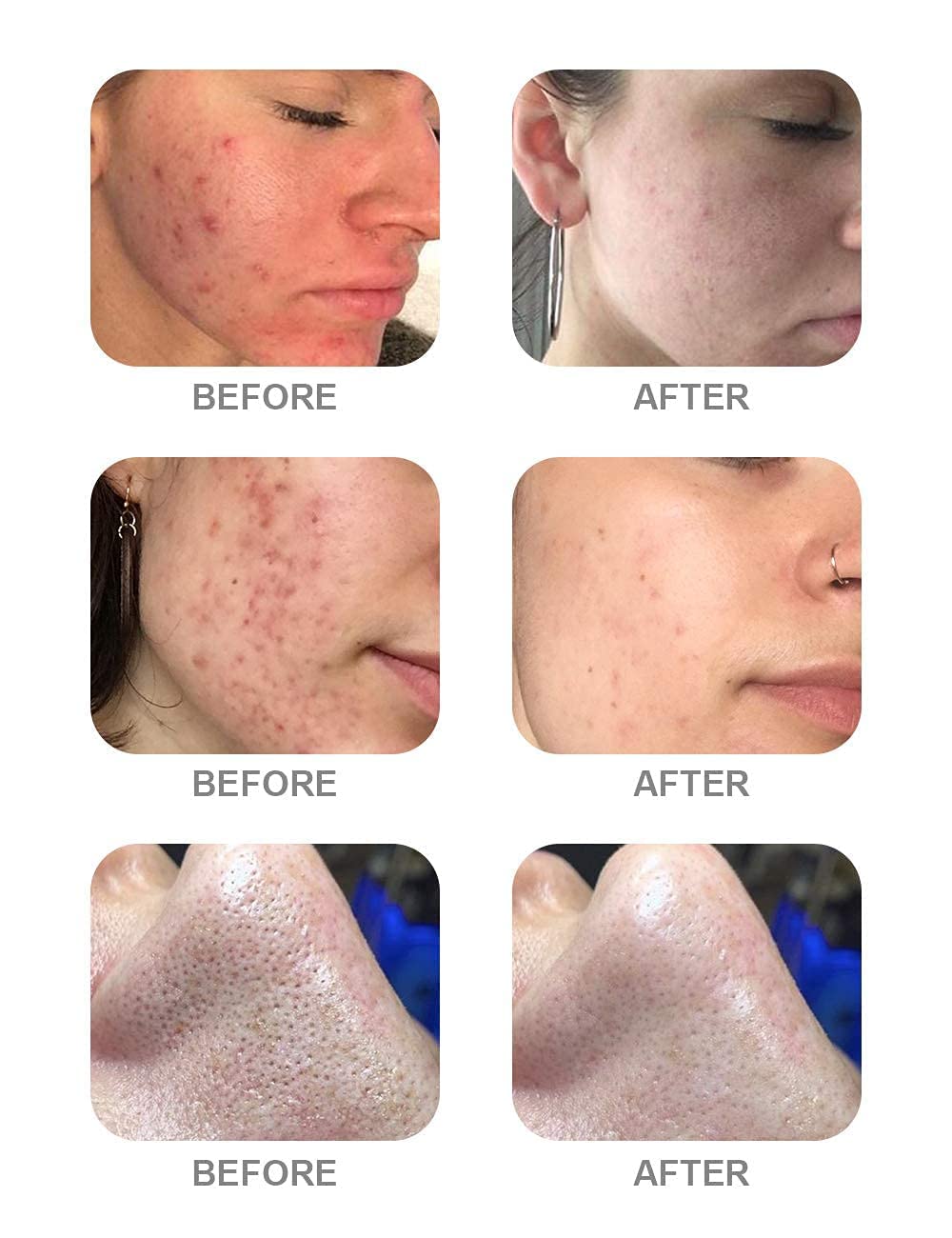 7 In 1 Hydra facial Machine (Double Motor) With Stand And Serum 3pcs (6 Months Warranty) - Image 10