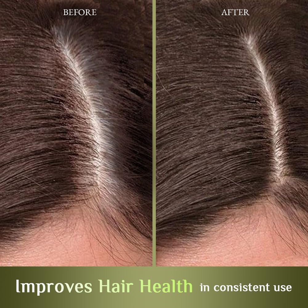 Richfeel Hair Nourisher 10Gm - Image 4