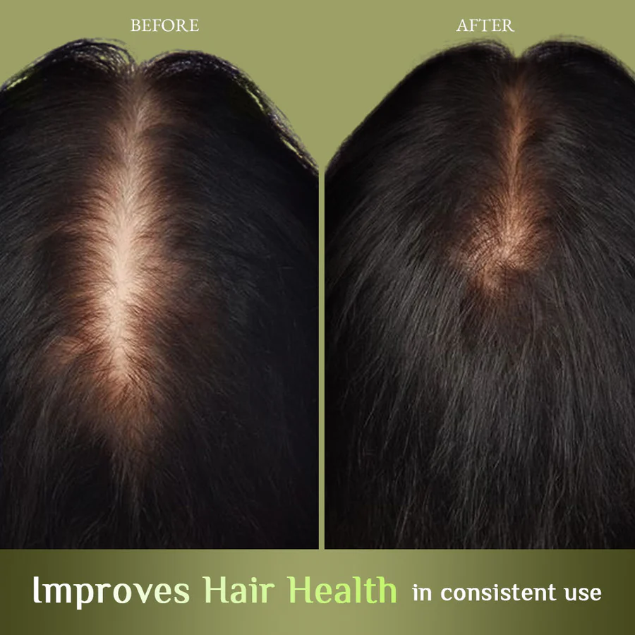 Richfeel Bhrami Jaborandi Hair Oil 80mi - Image 4
